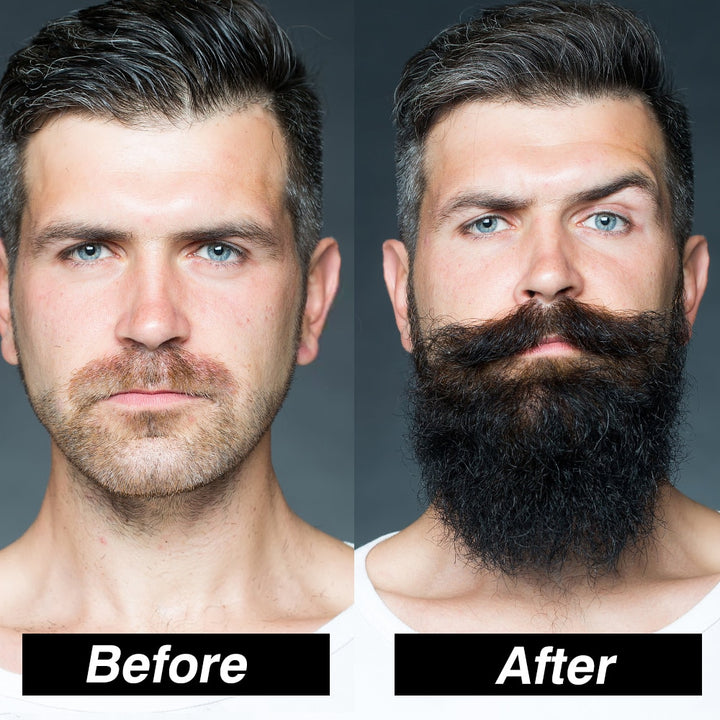 Beard Growth conditioners Kit.