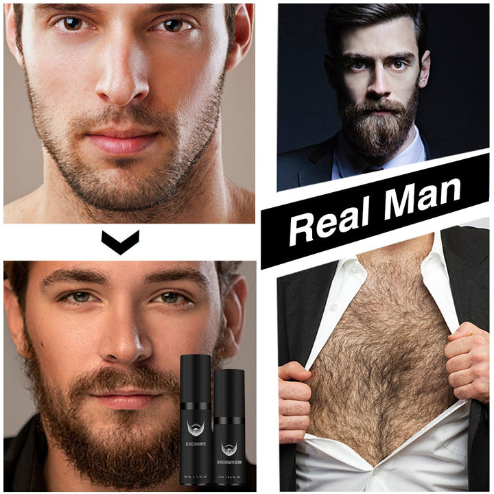 Beard Growth conditioners Kit.